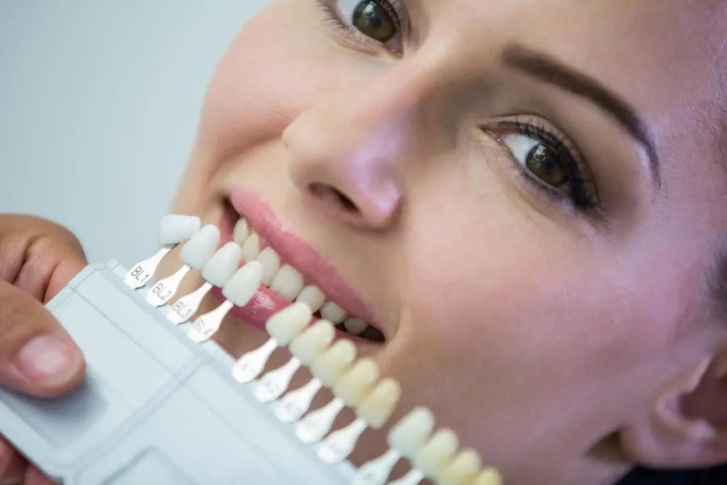 composite veneers near me
